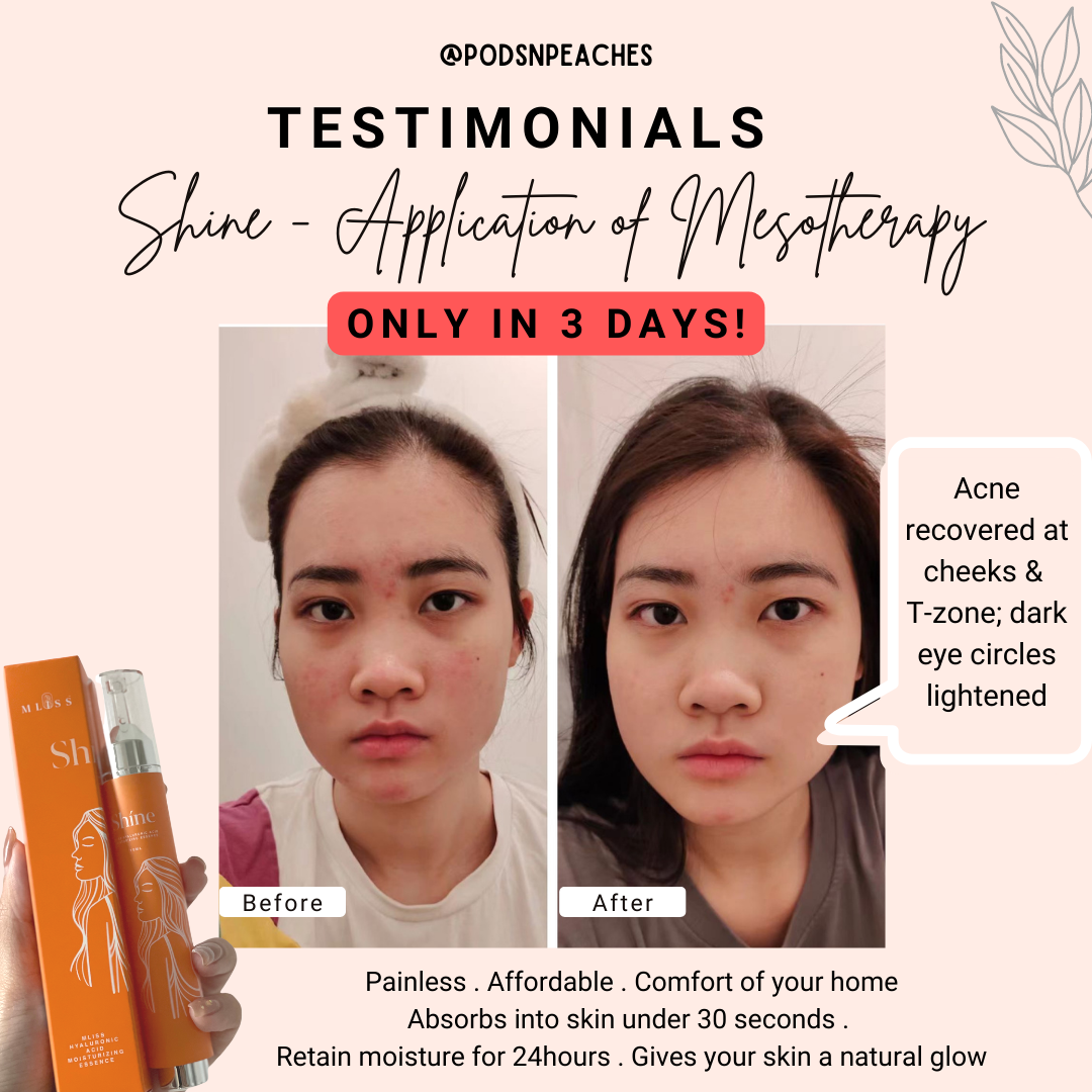 Mliss Shine Hyaluronic Acid Essence