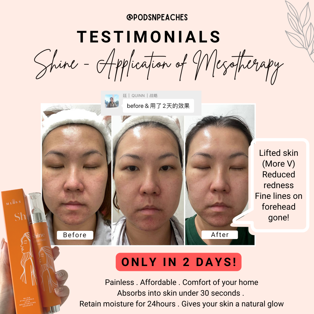 Mliss Shine Hyaluronic Acid Essence