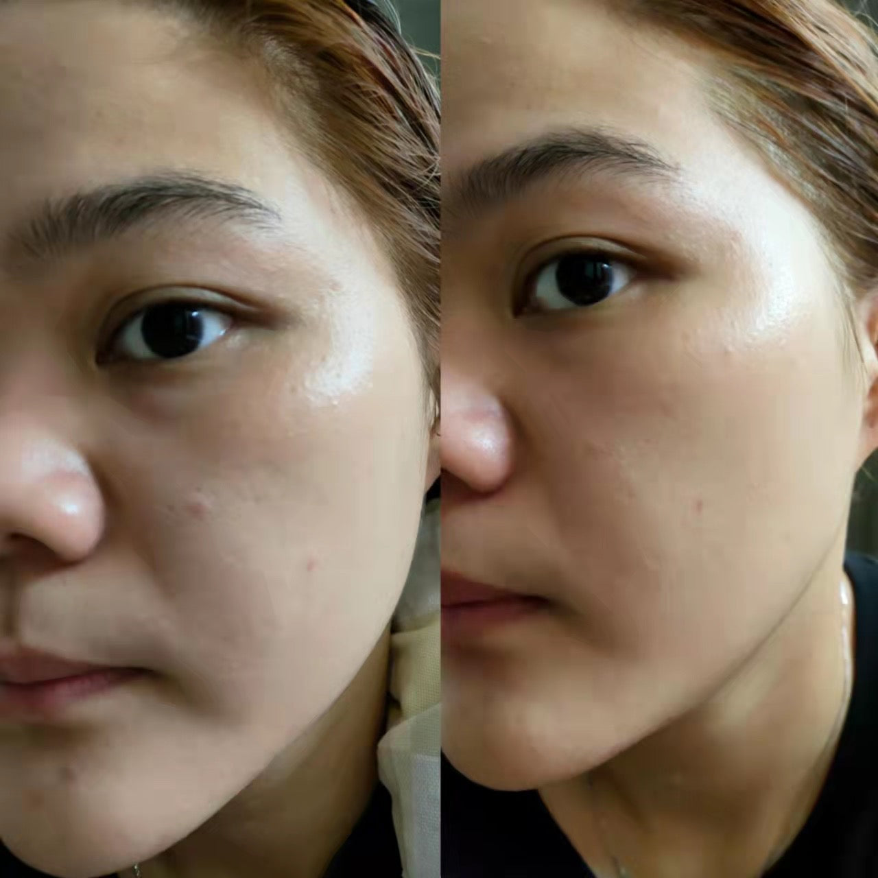 Mliss Vcare Soothing & Repairing Mask