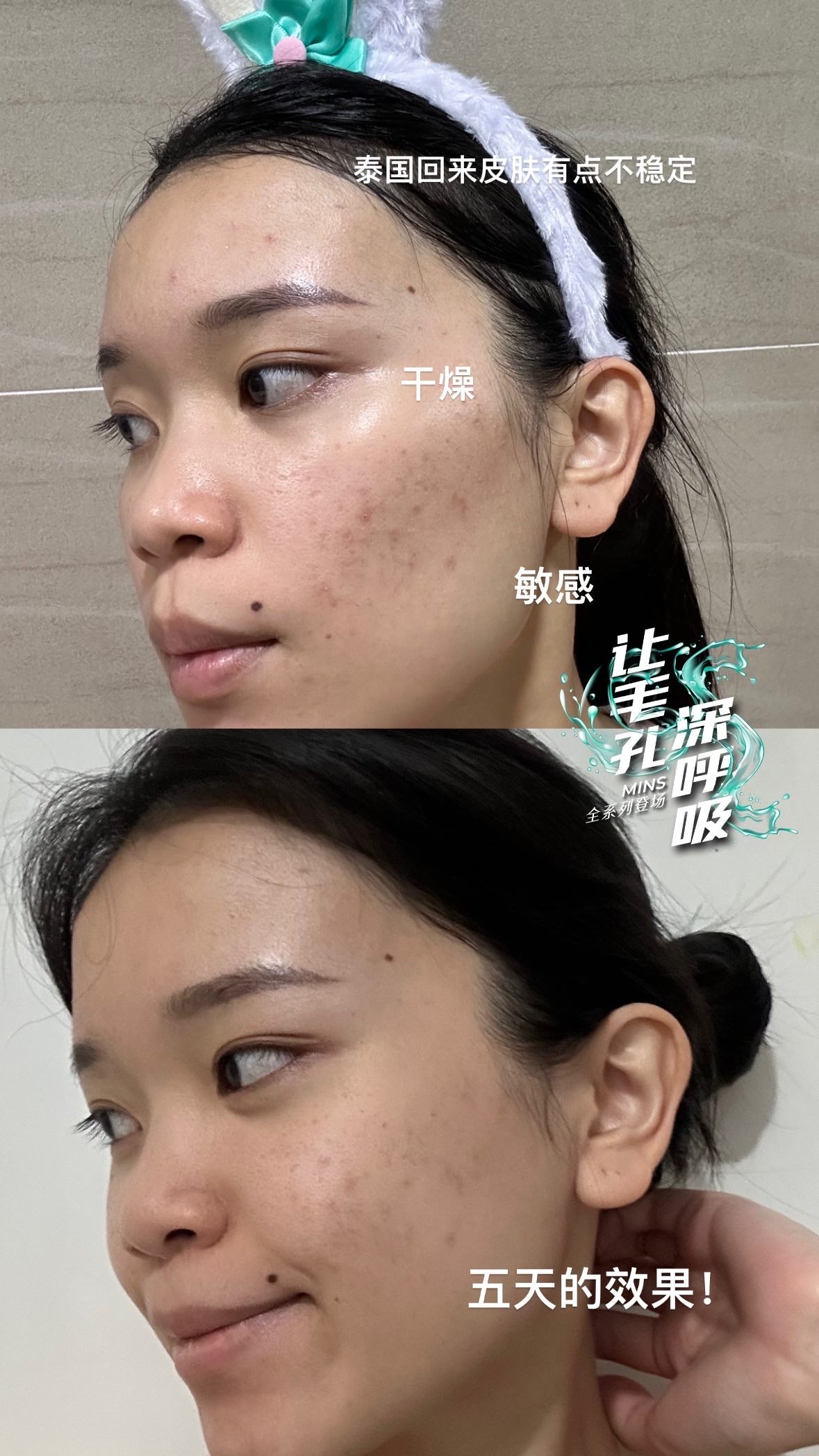 SOM1 Mins Cleansing Gel