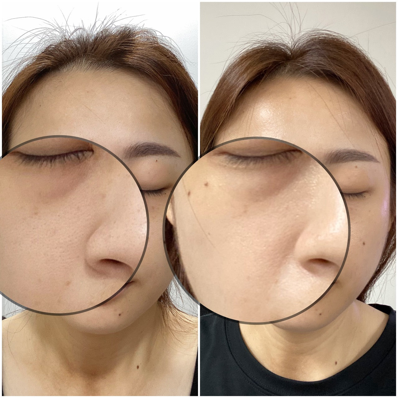 SOM1 Mins Cleansing Gel