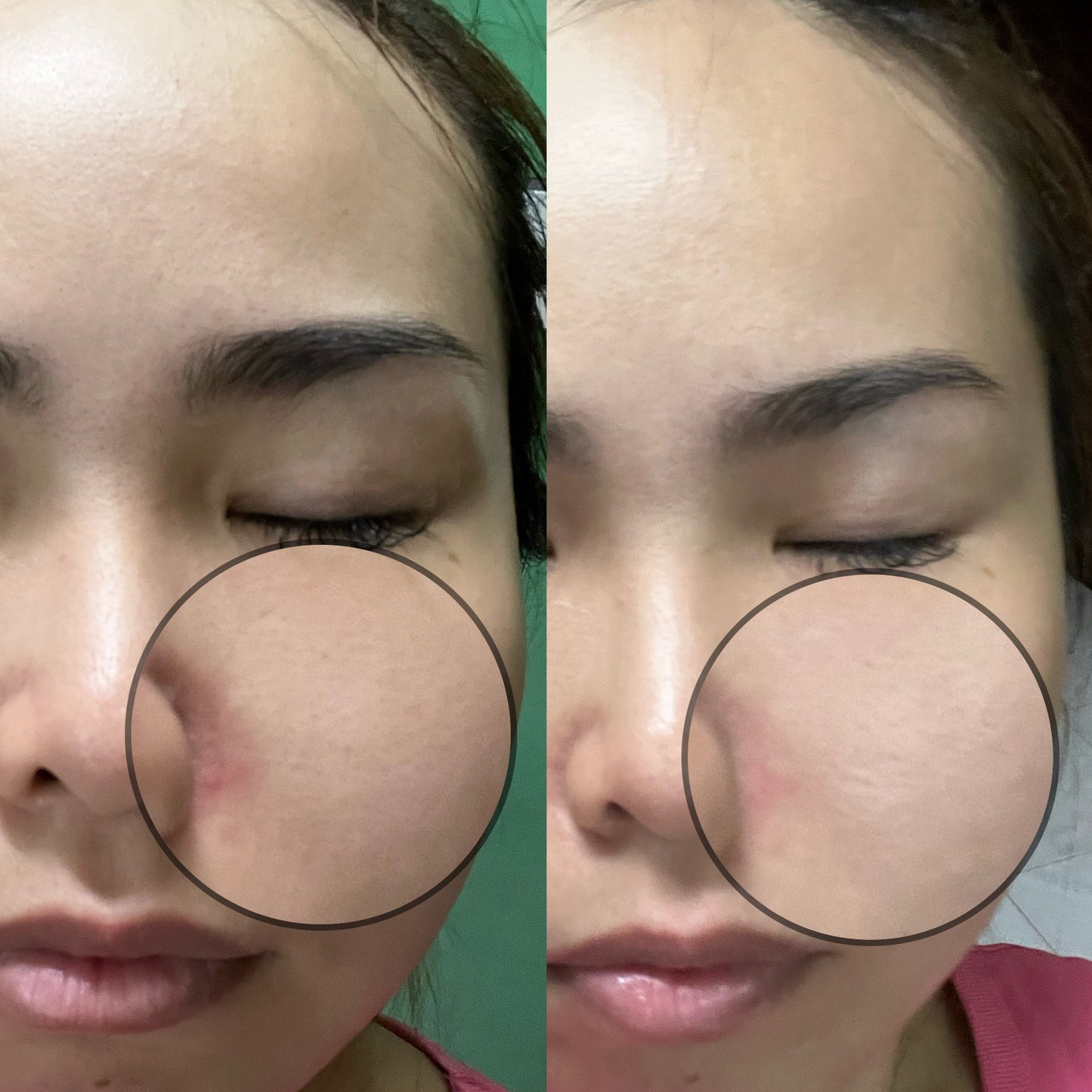 SOM1 Mins Cleansing Gel