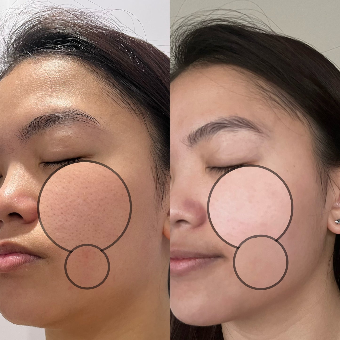SOM1 Mins Toner Pad