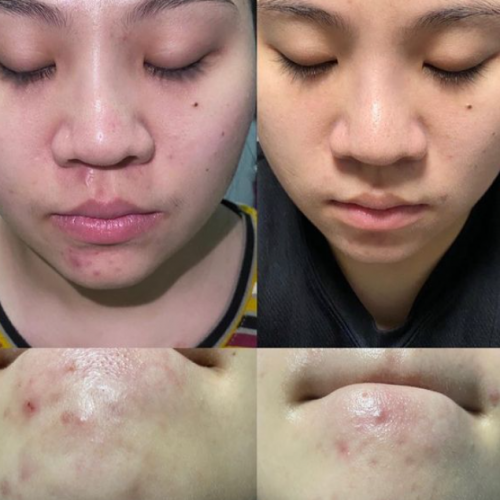 Dr Ora Crystal Luxe Collagen
