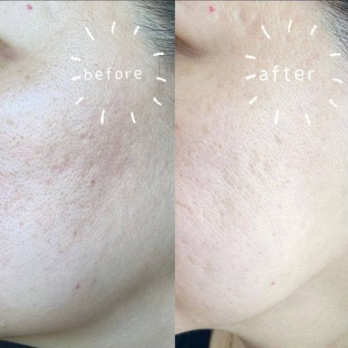 Dr Ora Crystal Luxe Collagen