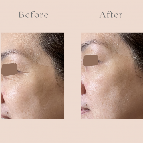 Dr Ora Crystal Luxe Collagen