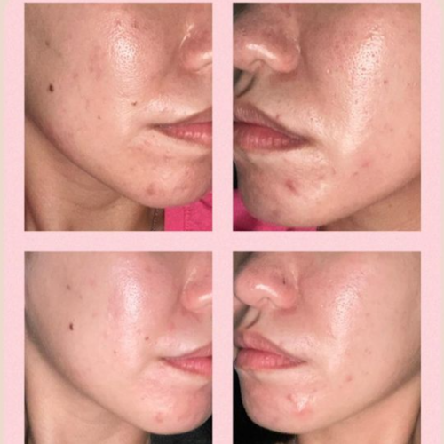 Dr Ora Crystal Luxe Collagen