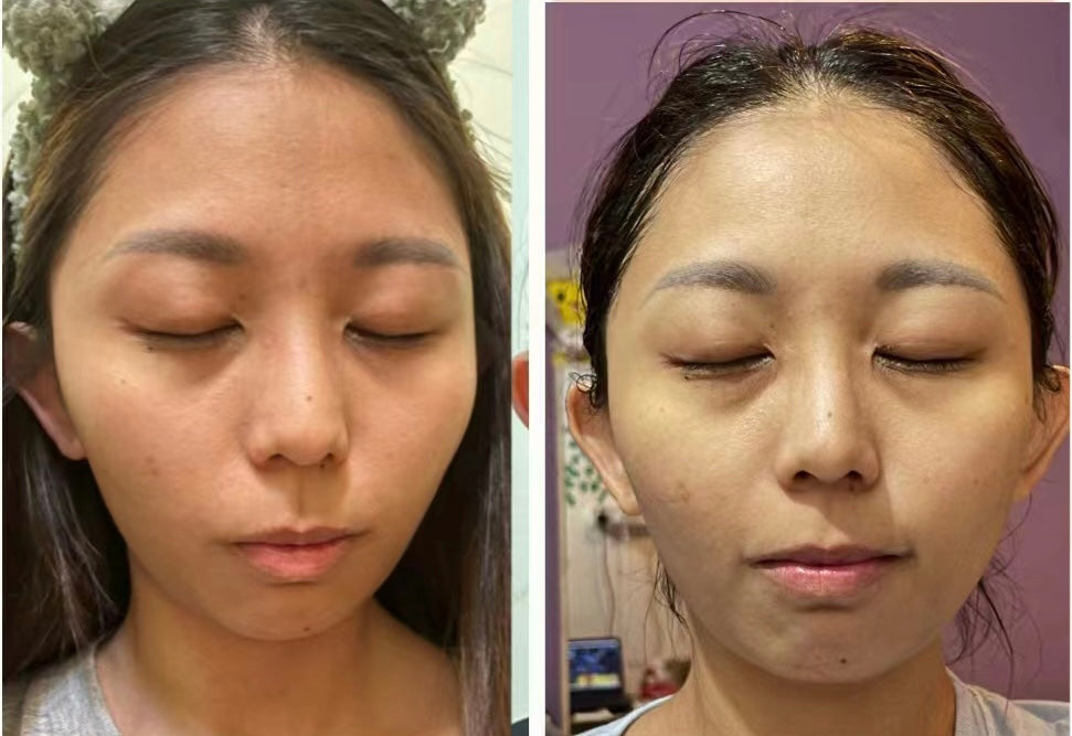 Mliss Vcare Soothing & Repairing Mask