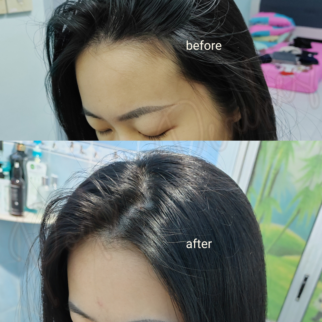 SOM1 SDEEN Root Booster