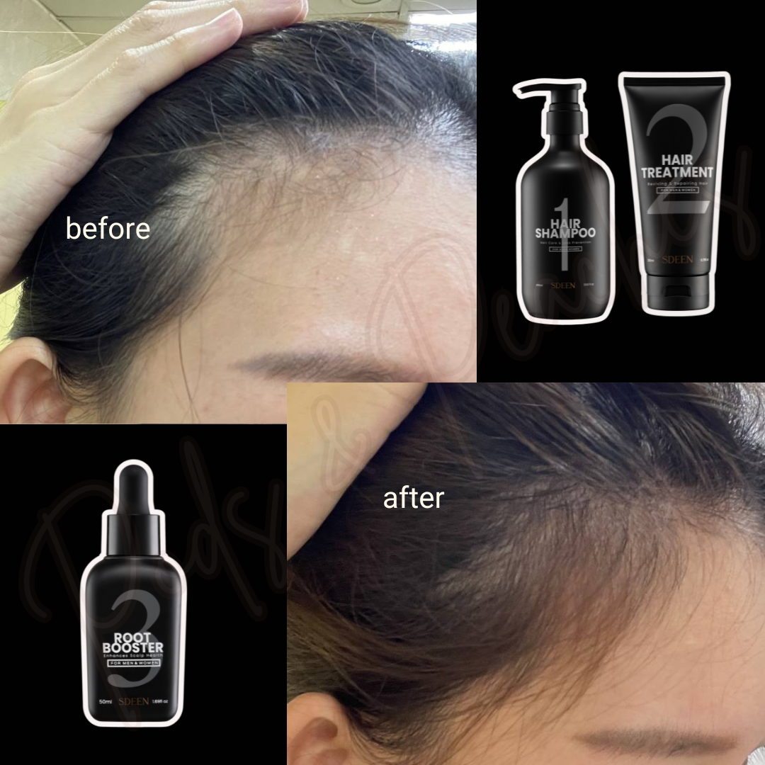 SOM1 SDEEN Root Booster