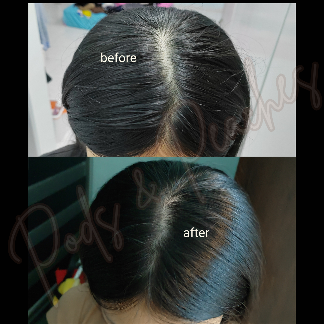 SOM1 SDEEN Root Booster