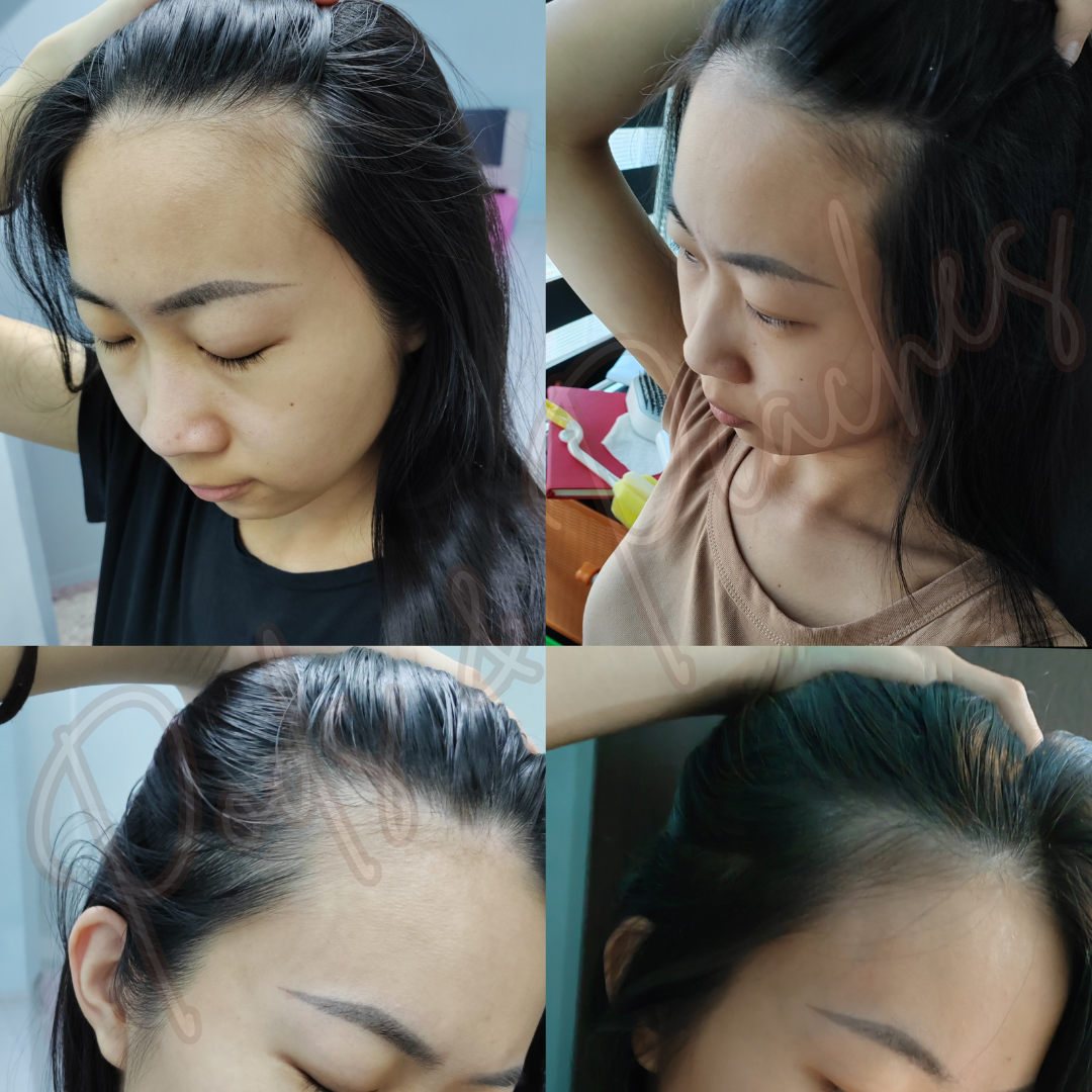 SOM1 SDEEN Root Booster