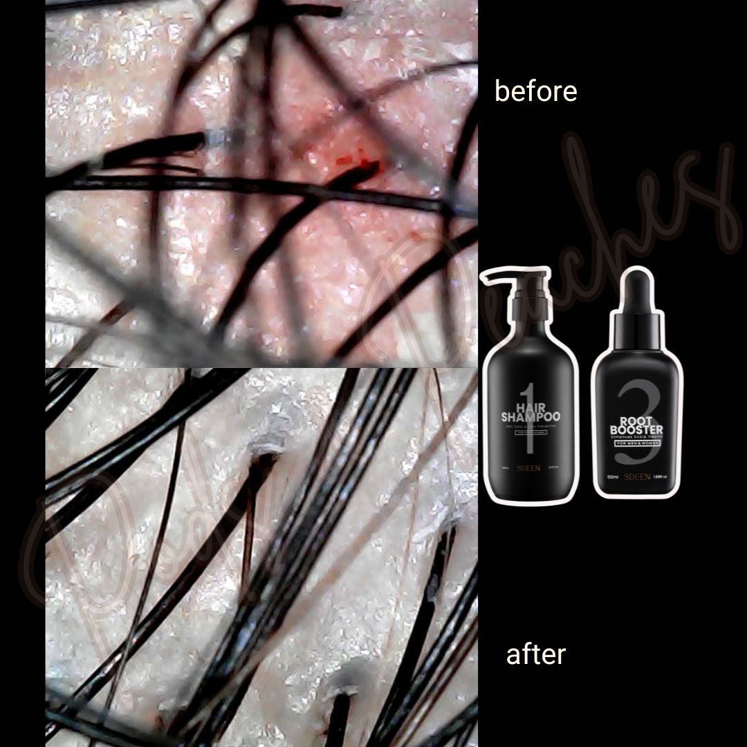 SOM1 SDEEN Hair Shampoo