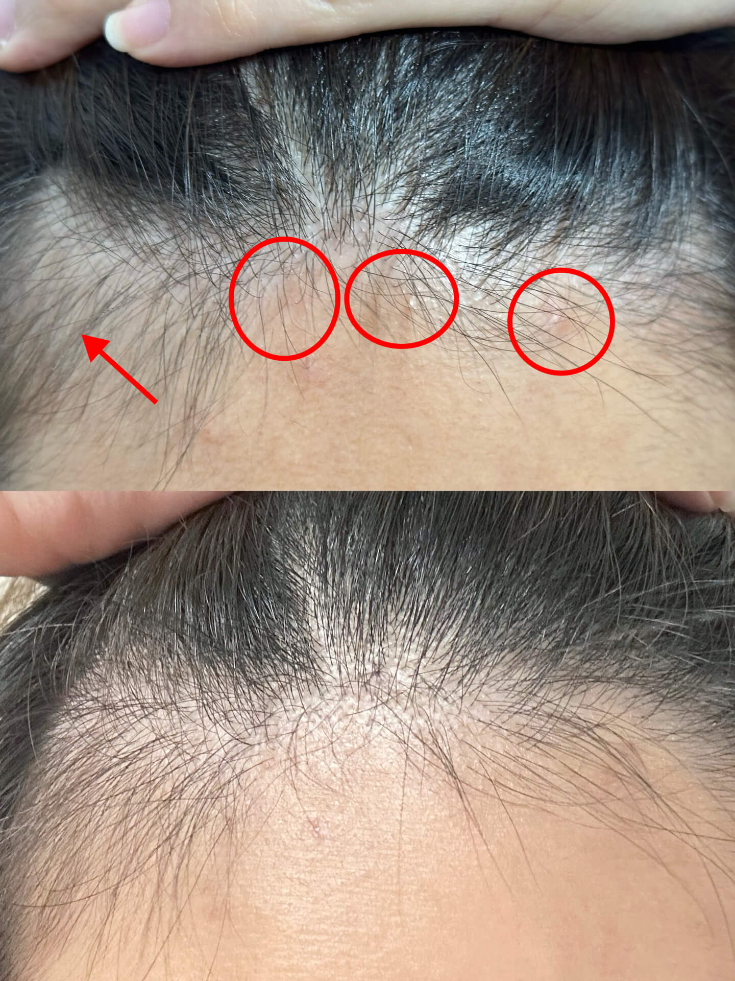 SDEEN Haircare Series (Shampoo, Treatment, Tonic)